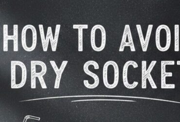 How to Avoid Dry Socket